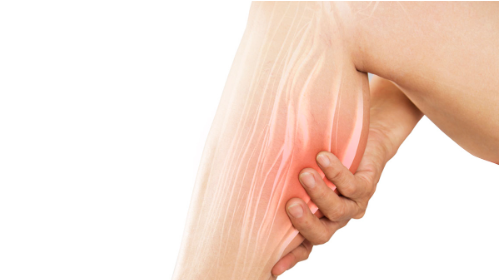 Ngërçet e muskujve: Shkaqet dhe si t’i parandaloni