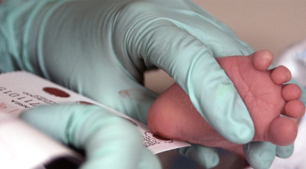 Skriningu neonatal në QKUK shpëton jetë: Mbi 2 mijë foshnje të testuara