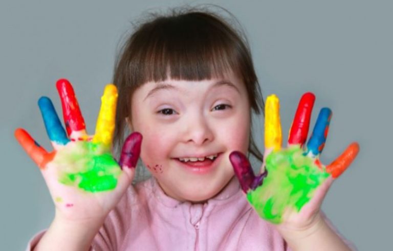 Shoqata “Down Syndrome Kosova” shënon Ditën Botërore të Sindromës Down