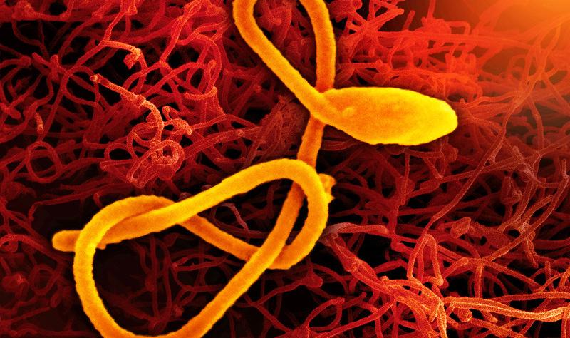 IKSHPK: Rrezik i ulët për Ebola në Kosovë
