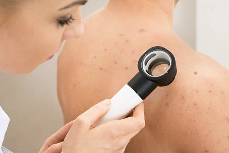 8 shenja që mund të tregojnë çrregullime hormonale